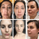 Vitamin C Whitening Serum Effective Remove Dark Spots Freckles Fade Melanin Anti-Wrinkle Brightening Nourishing Face Skin Care