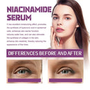 20% Niacinamide B3 Firming Essence Shrink Pores And Deeply Moisturize Reduce Wrinkles Smooth Pores Serum Skin Care