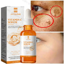 Vitamin C Whitening Serum Effective Remove Dark Spots Freckles Fade Melanin Anti-Wrinkle Brightening Nourishing Face Skin Care