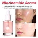 Niacinamide Serum 30ml Brightening Pore Minimizer Fade Dark Spots Hydrating Even Skin Tone Anti Aging Face Serum Non Irritating