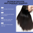 Selenium Sulfide Shampoo Fight Persistent Dandruff Soothes Itchy Scalp Controls Excess Oil Deep Purifying Moisturizing Hair Care