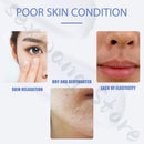 Moisturizing and soothing cream 80ml repairs barrier, improves dry and peeling skin, deeply hydrates and soothes face