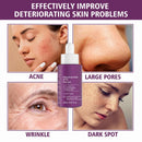 20% Niacinamide B3 Firming Essence Shrink Pores And Deeply Moisturize Reduce Wrinkles Smooth Pores Serum Skin Care