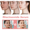 Niacinamide Serum 30ml Brightening Pore Minimizer Fade Dark Spots Hydrating Even Skin Tone Anti Aging Face Serum Non Irritating