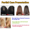 Scalp Care Growth Hair Device 3-Levels Phototherapy Anti Hair Loss Scalp Treatment Alopecia Areata Hair Frizzy Repair Relax Gift