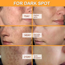 Vitamin C Whitening Serum Effective Remove Dark Spots Freckles Fade Melanin Anti-Wrinkle Brightening Nourishing Face Skin Care