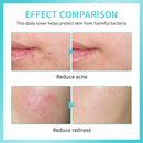 PH Balancing Toner Daily Rescue Facial Spray for Sensitive Skin Hypochlorous Acid Spray Helps Reduce Redness Breakouts Soothing