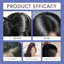 Selenium Sulfide Shampoo Fight Persistent Dandruff Soothes Itchy Scalp Controls Excess Oil Deep Purifying Moisturizing Hair Care