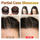 Scalp Care Growth Hair Device 3-Levels Phototherapy Anti Hair Loss Scalp Treatment Alopecia Areata Hair Frizzy Repair Relax Gift